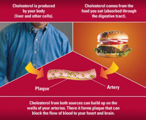 5 foods that fight high cholesterol